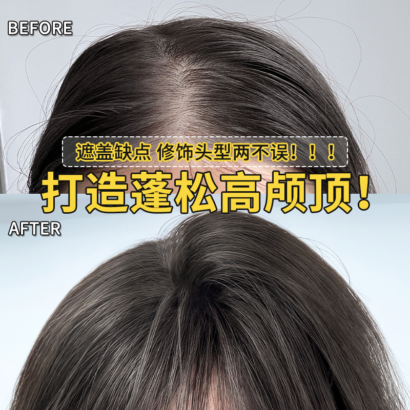 【打造蓬松高颅顶】递针无痕假发