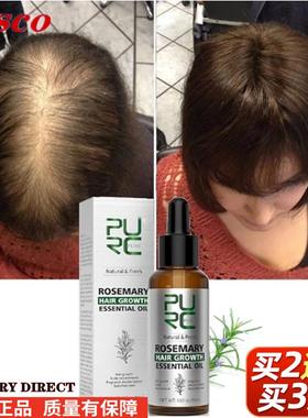 Purc Rosemary Ginger Hair Growth essential oil Fast Regrowth