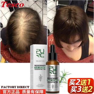 Purc Rosemary Ginger Hair Growth essential oil Fast Regrowth