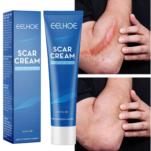Scar Removal Cream Repairing Pock Mark Burn Surgical Scar