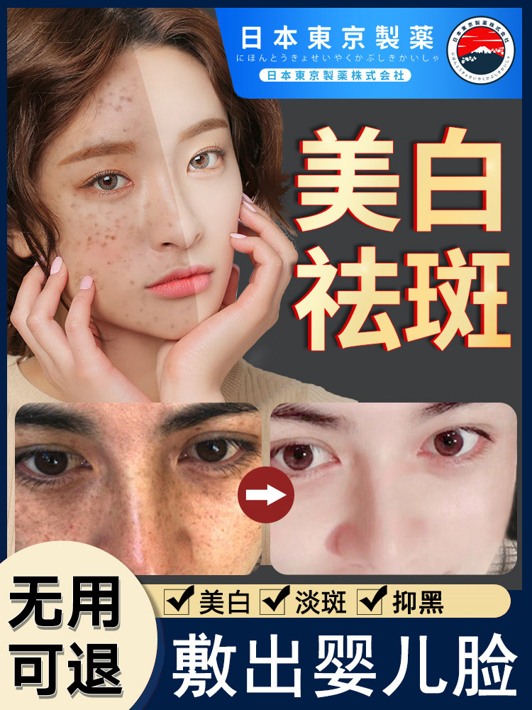 老年斑黄褐斑晒斑祛斑美白去痘印孕妇哺乳期可用