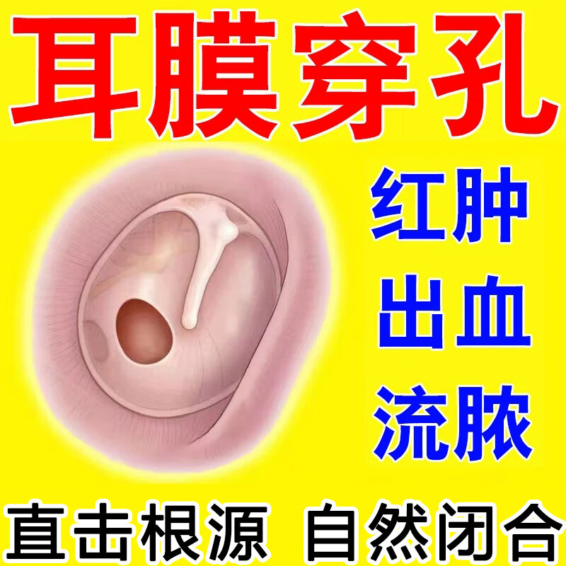 中耳炎双氧水耳聋左慈丸北京同仁堂组合滴耳液真菌霉菌感染耳道炎
