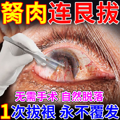 蔡敏维滴眼液眼药水氨碘钛肽飞蚊症专用特效治疗的药缓解眼疲劳润