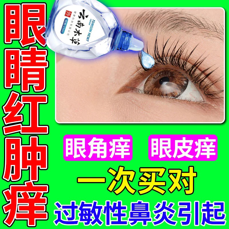 七叶洋地黄双苷滴眼滴眼液人工泪液眼药水缓解视疲劳干涩