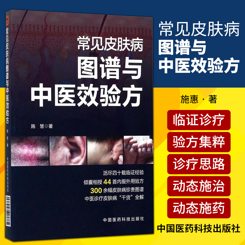 正版常见皮肤病图谱与中医效验方施慧章节之下有痤疮脂溢性皮炎带状疱疹银屑病等常见皮肤病*具辨识度的图片等中国医药科技出版社 书籍/杂志/报纸 医学图谱 原图主图