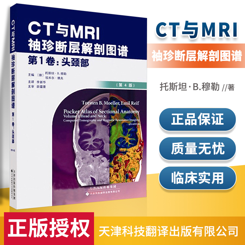 正版CT与MRI袖珍断层解剖图谱 第1卷 头颈部 头颈部影像诊断学 头影测量 ct读片 医学影像 ct诊断与临床 天津科技翻译出版有限公司