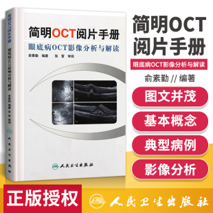 人民卫生出版 OTC基本原理与技术 眼底病OCT影像分析与解读 正版 社 简明OCT阅片手册 基础阅片影像眼科学视光技术应用 俞素勤 保证