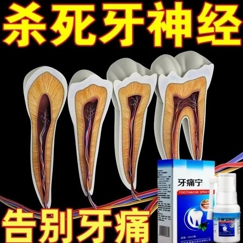杀死牙神经去牙疼牙痛立可停专用速效牙膏治牙龈肿消痛炎龋齿喷剂
