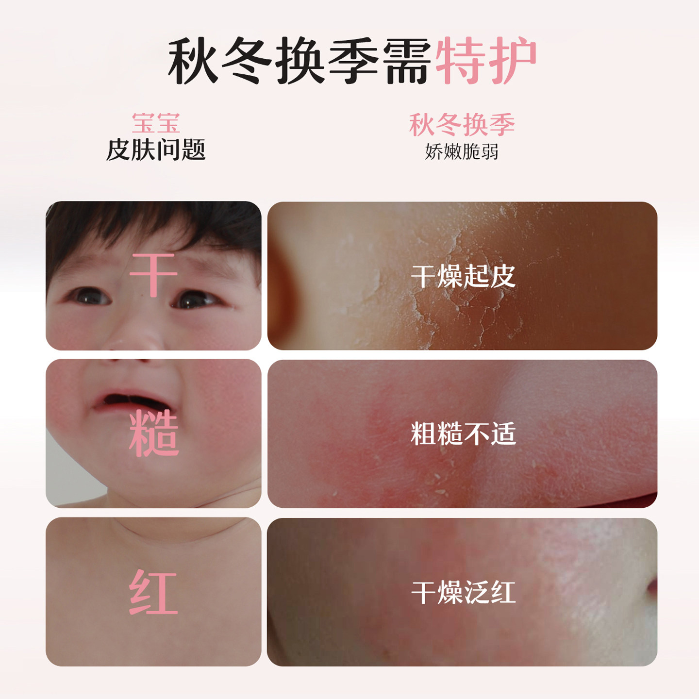 【李佳琦】松达婴儿山茶油舒缓特护霜新生保湿面霜,婴童洗护,润肤乳,淘宝优惠券,粉丝福利购,淘宝优惠卷