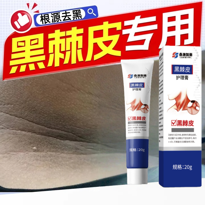 去脖子黑棘皮乳膏黑色素洗不干净肥胖脖颈关节黑儿童成人专用乳膏