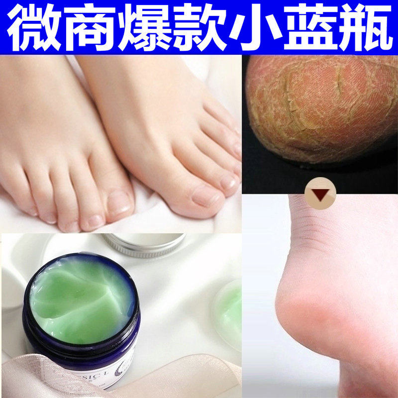 老中医小蓝瓶脚后跟角化型干裂修护雪膏手足开裂手脚脱皮修复言霜