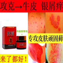 治藓癣抑菌皮肤湿疹瘙痒止痒过敏头痒股止痒外用牛皮专用药膏