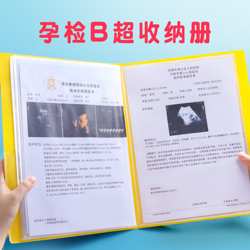 单子收纳册便携档案b超孕检
