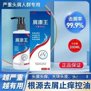 屑康王去屑止痒洗发水正品严重头屑头痒除螨头皮屑控油洗发男女膏