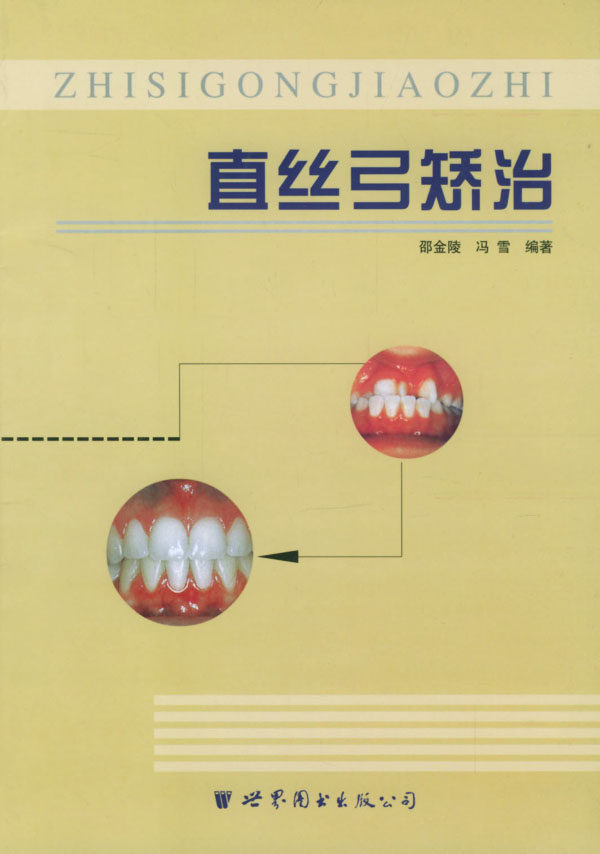 【正版包邮】 直丝弓矫治 邵金陵 世界图书出版社