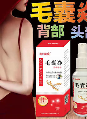 毛囊焱喷剂可挖裉红疙瘩痘痘头皮头部背部脖子马拉色菌抑菌止痒液