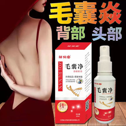 毛囊焱喷剂可挖裉红疙瘩痘痘头皮头部背部脖子马拉色菌抑菌止痒液