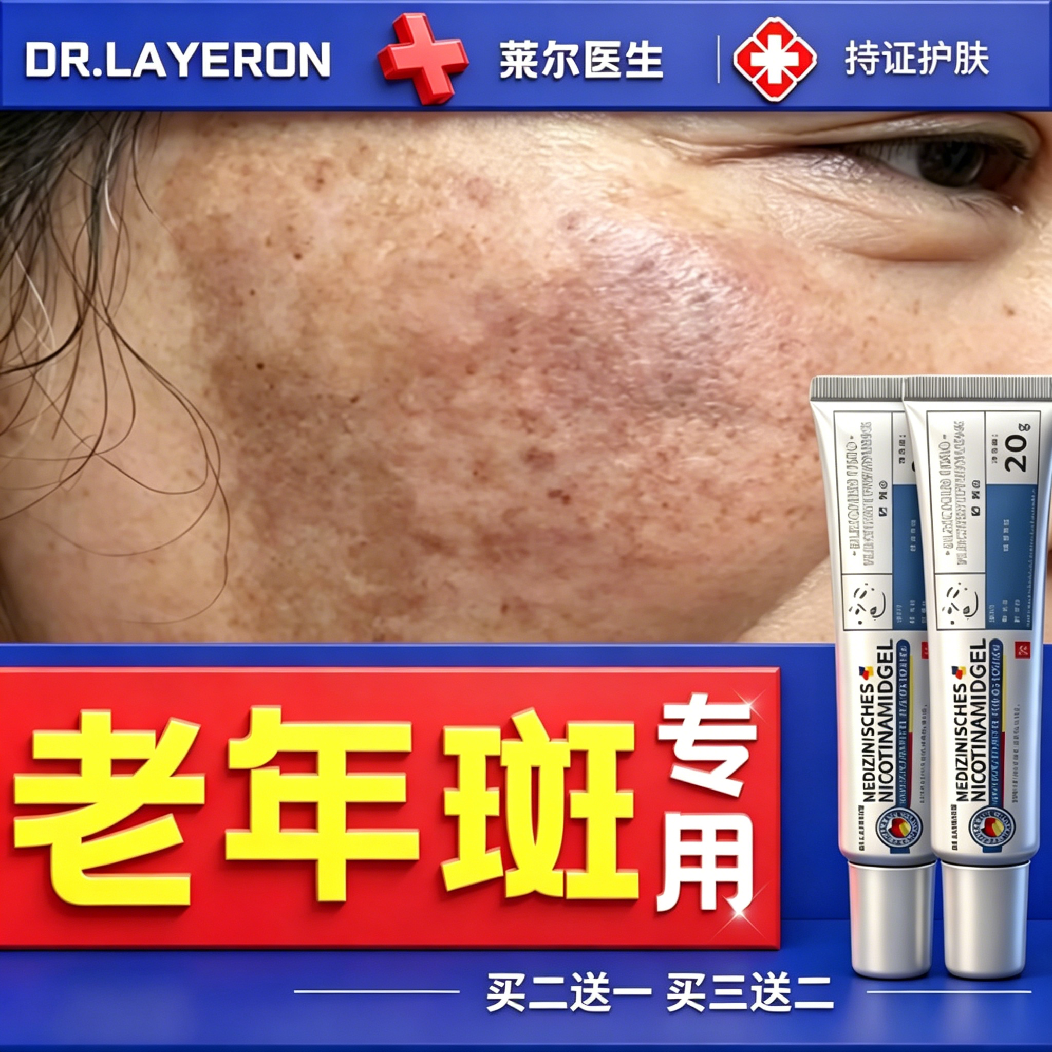 烟酰胺祛斑霜老年斑力去除手部脸部专用晒黄褐斑男士一擦就掉消夜