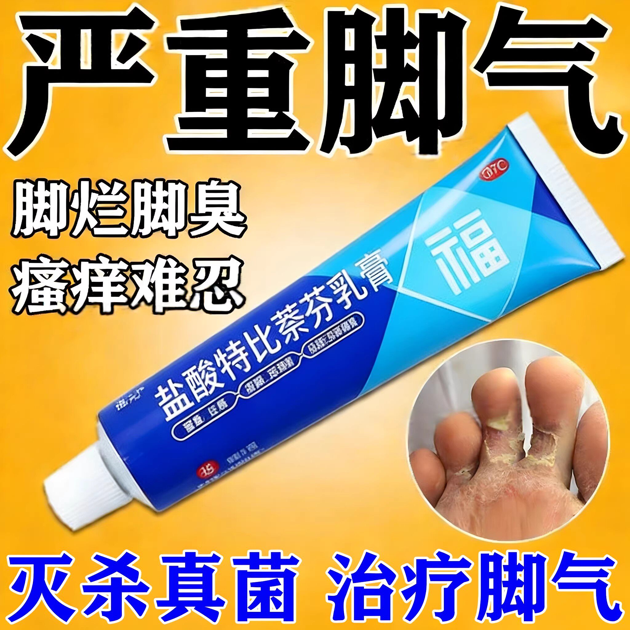 脚气药膏盐酸特比萘芬乳膏正品专用止痒脱皮杀菌皮肤真菌感染脚痒