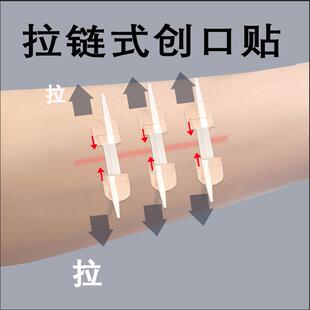 医用绷带疤痕减张伤口免缝张力贴拉链式创口贴易拉得儿童世瑞绷带