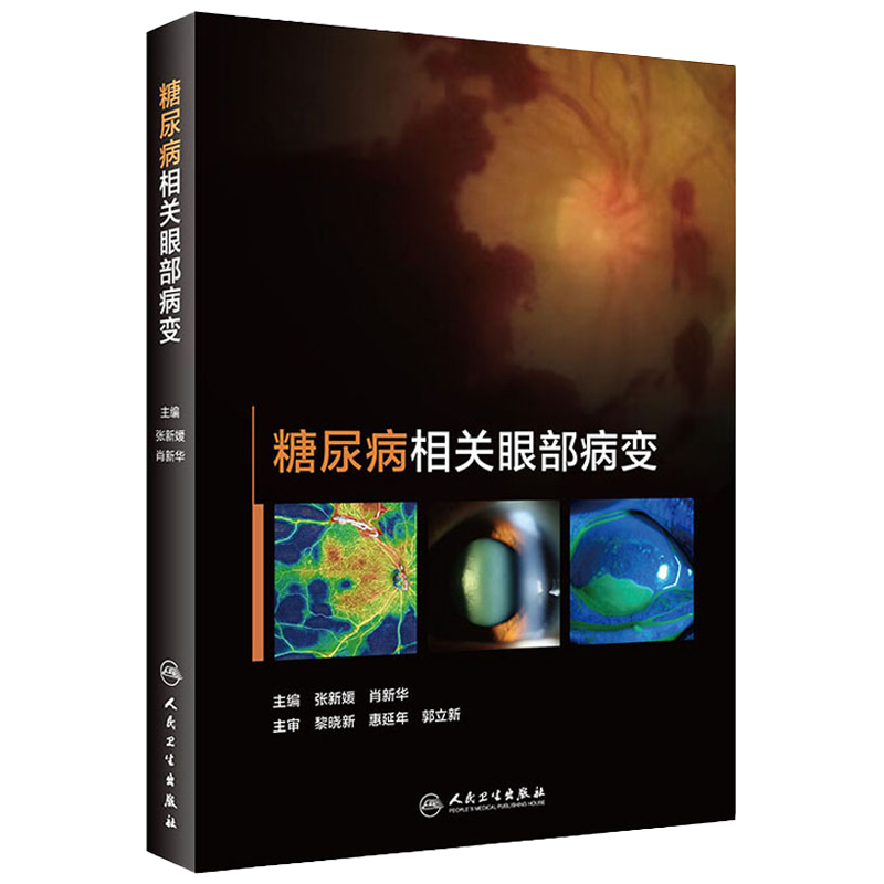 糖尿病相关眼部病变 眼毛细血管视网膜病变黄斑水肿眼表肌白内障眼底病视光视力恢复角膜青光眼人民卫生出版社实用手术眼科书籍