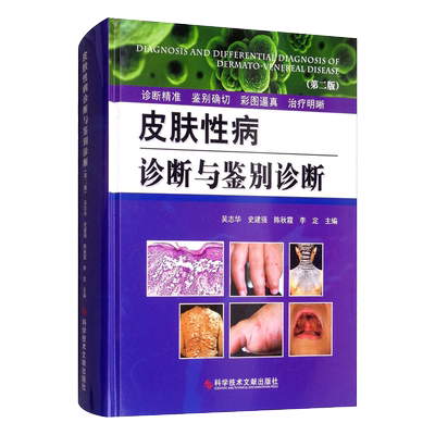 皮肤性病诊断与鉴别诊断