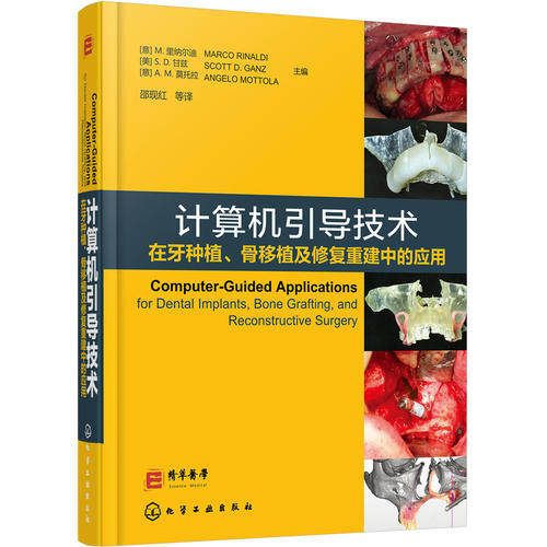计算机引导技术在牙种植骨移植及修复重建中的应用M.里纳尔迪化学工业出版社临床病例口腔科医学书籍部分牙列缺失上颌无牙颌骨移植