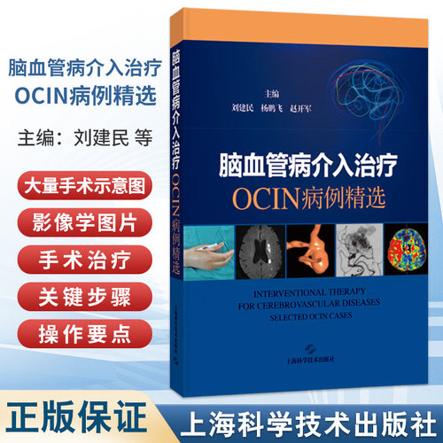 脑血管病介入治疗OCIN病例精选 刘建民 杨鹏飞 赵开军 多家三甲医院脑血管病中心精心筛选的典型脑血管病病例 上海科学技术出版社