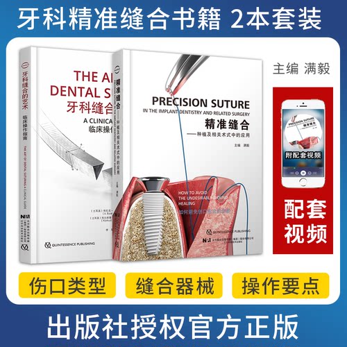 精准缝合满毅+牙科缝合的艺术