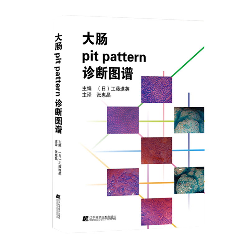 包邮正版 大肠pit pattern诊断图谱 (日)工藤进英 辽宁科学技术出版社 肠镜消化内镜操作手册实用消化病学图谱内科学消化内科书籍