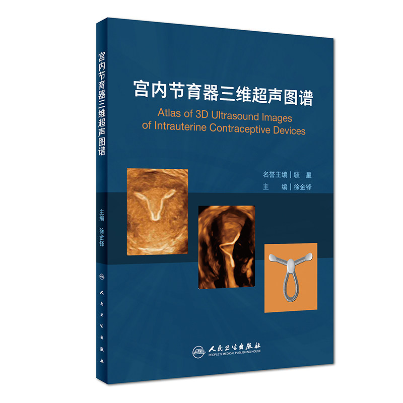 正版书 宫内节育器三维超声图谱 详细介绍各类节育器种类三维超声表现