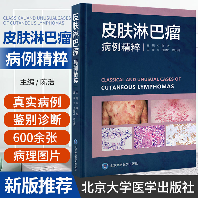 包邮 正版 皮肤淋巴瘤病例精粹 陈浩 主编 北京大学医学出版社 9787565927072 皮肤淋巴瘤临床真实病例彩色图谱