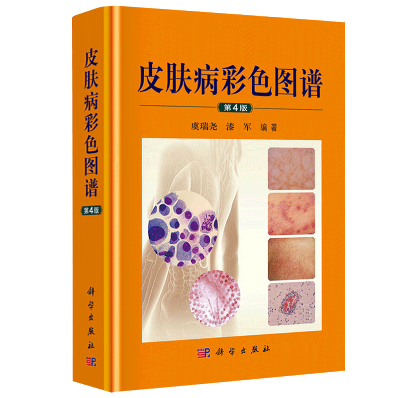 正版 皮肤病彩色图谱 第4四版 皮肤病图谱彩图版 临床皮肤病学 皮肤病书籍大全 皮肤科医学书 700余种皮肤性病科治疗的常见病书籍