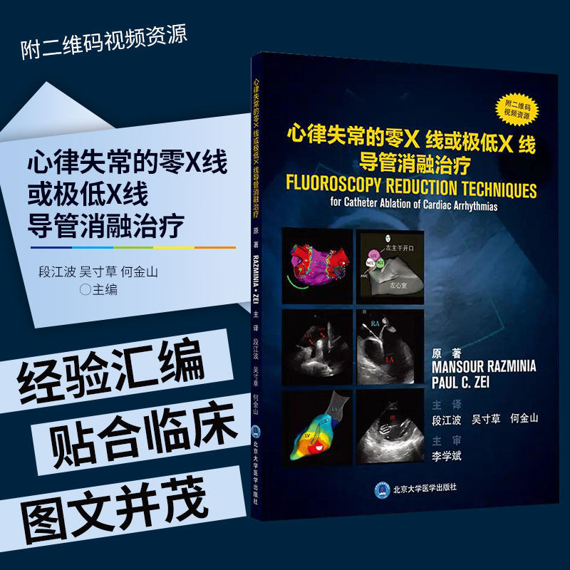 心律失常零极低X线导管消融治疗