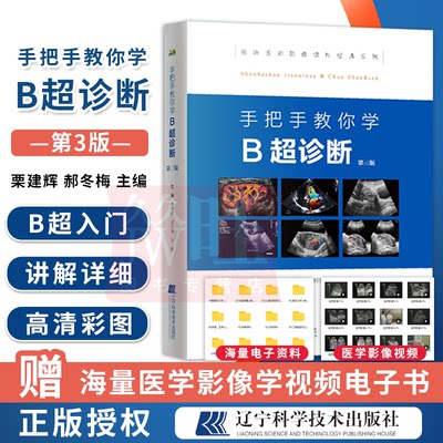 手把手教你学B超诊断b超书中级诊断书彩色多普勒彩超设备检查技术报告入门书系医学超声影像学超声诊断学心脏腹部乳腺四肢肌骨血管