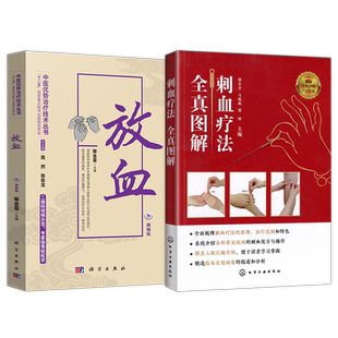 正版2本 刺血疗法全真图解+放血疗法教程刺络法 刺血治病一本通拔罐放血治百病中医优势治疗技术经络穴位王秀珍中国民间刺血术书籍