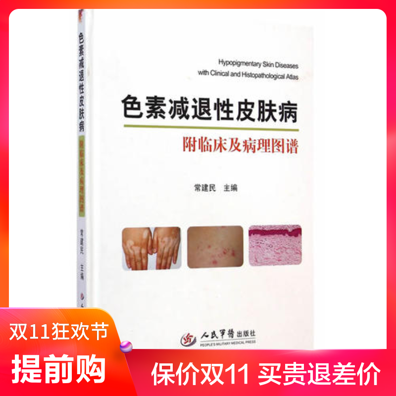 现货 原装正版 色素减退性皮肤病（附临床及病理图谱）常建民 主编 人民军医出版社 9787509179758 皮肤科学书籍