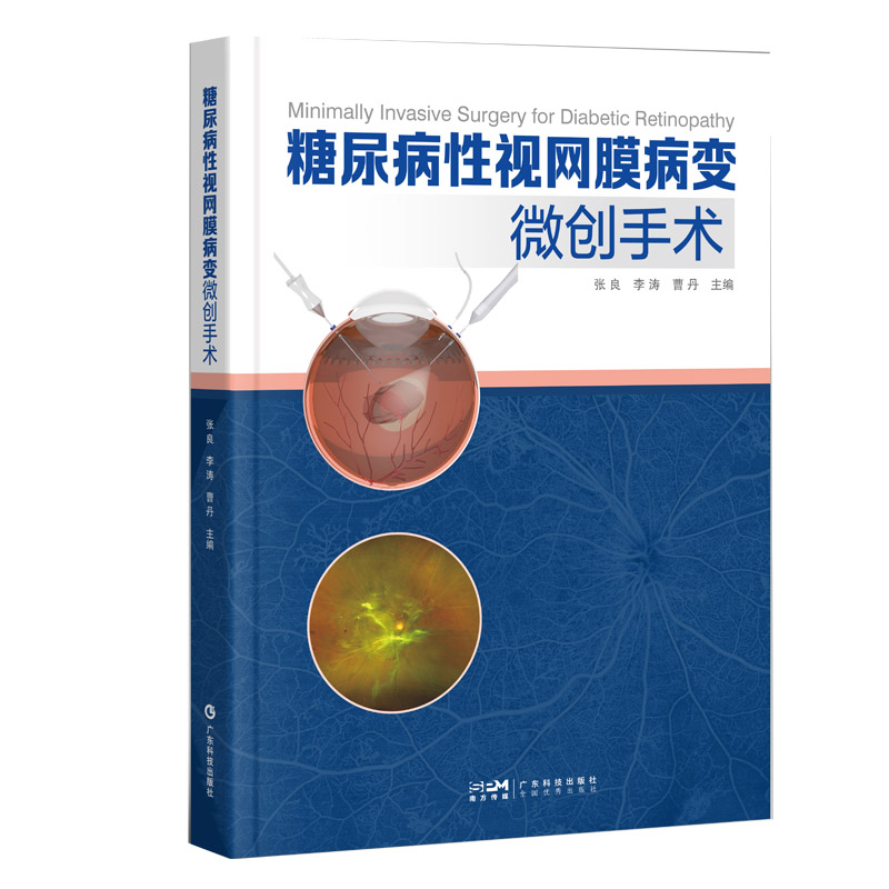 正版 糖尿病性视网膜病变微创手术 配有27个手术视频 关注手术操作细节 包括器械准备参数设置出血控制增殖膜处理等关键环节