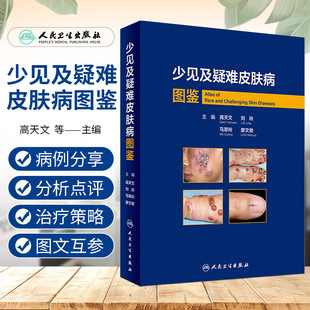 正版 少见及疑难皮肤病图鉴 高天文西京皮肤医院经病理诊断的少见疾病及临床错诊获修正的不典型疾病 人民卫生出版社9787117357272