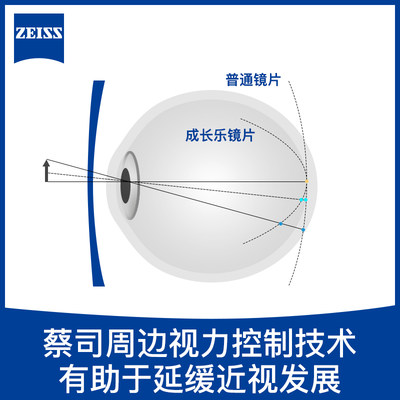 蔡司青少年儿童防控离焦近视镜片成长乐控制度数增长延缓度数加深
