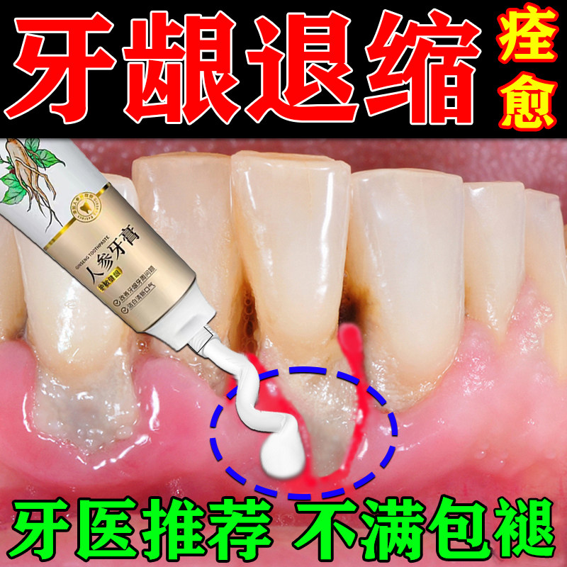 牙龈牙根暴露萎缩抗敏感牙齿酸软痛出血护理美白固齿专用人参牙膏,洗护清洁剂/卫生巾/纸/香薰,牙膏,淘宝优惠券,粉丝福利购,淘宝优惠卷