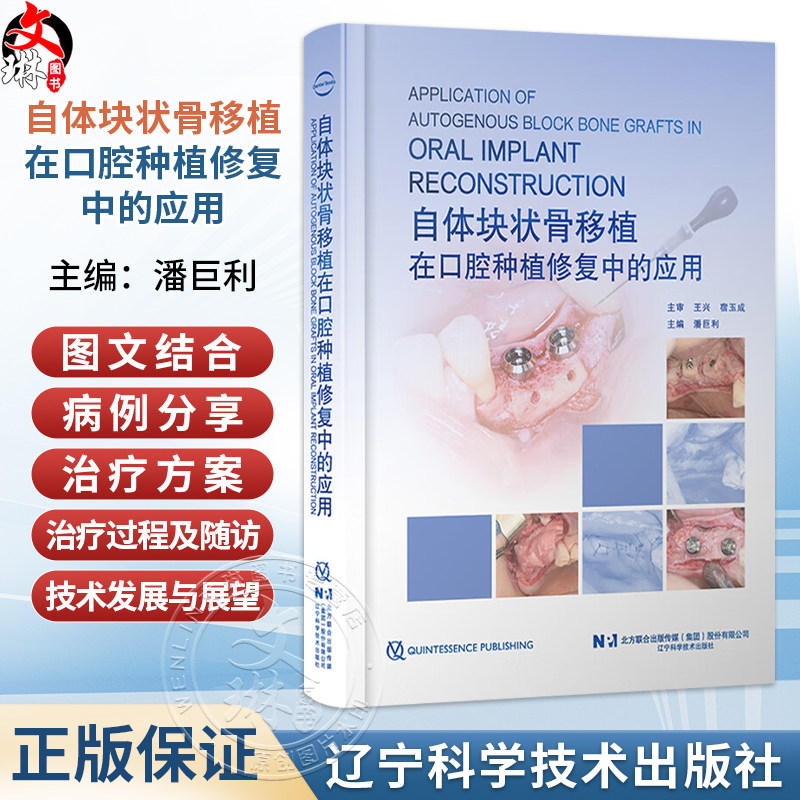 自体块状骨移植在口腔种植修复中的应用 潘巨利 主编 自体块状骨移植技术的发展与展望 移植骨的生物学特点等 辽宁科学技术出版社
