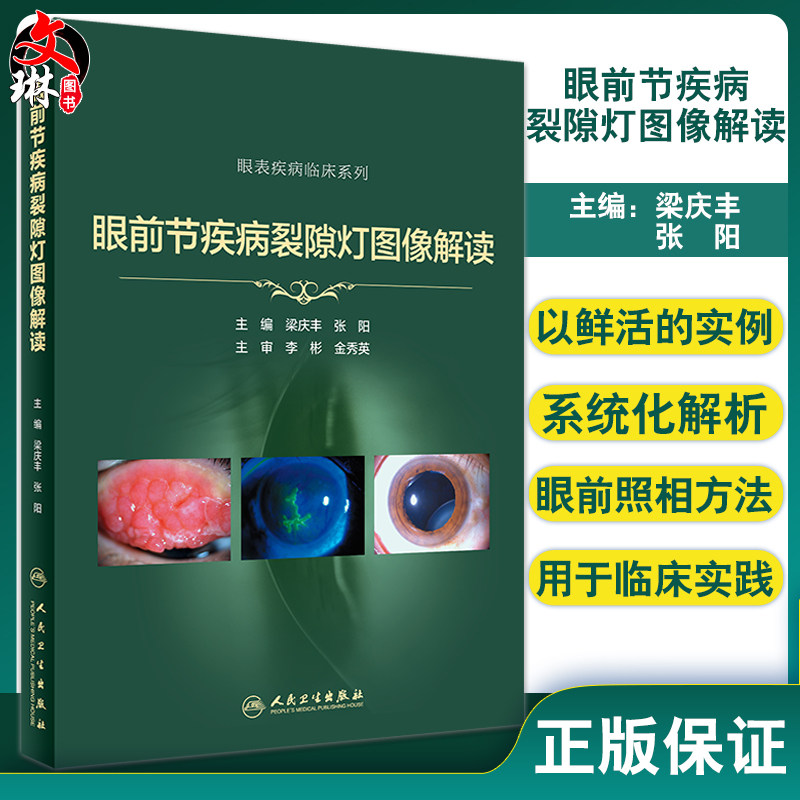 预售眼前疾病裂隙图像解读