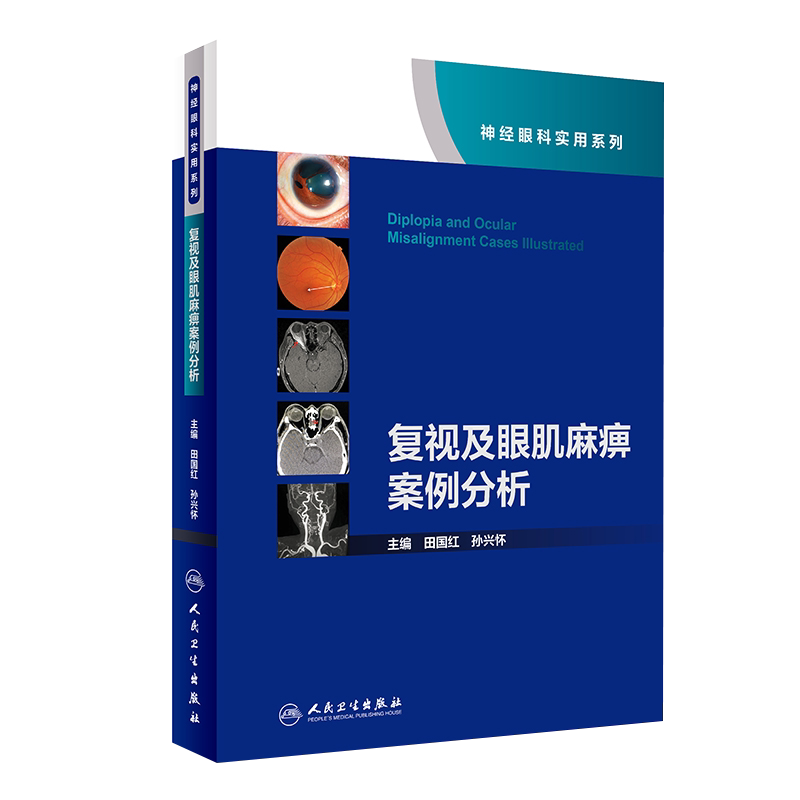 复视及眼肌麻痹案例分析神经眼科实用系列 田国红孙兴怀 眼科学视神经疾病看图识病疑难杂症罕见病例人民卫生出版社眼科书籍
