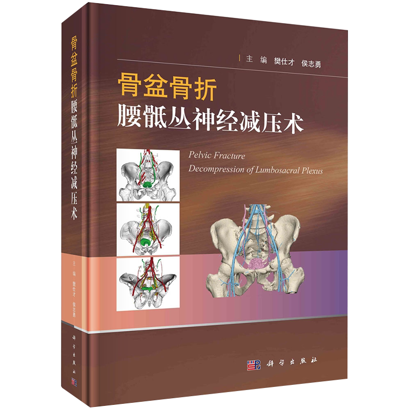 预售骨盆腰骶丛神经减压樊仕才