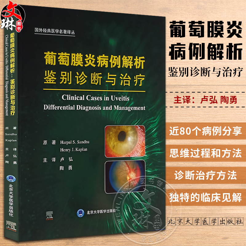 葡萄膜炎病例解析鉴别诊断与治疗