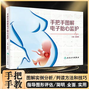 手把手图解电子胎心监护