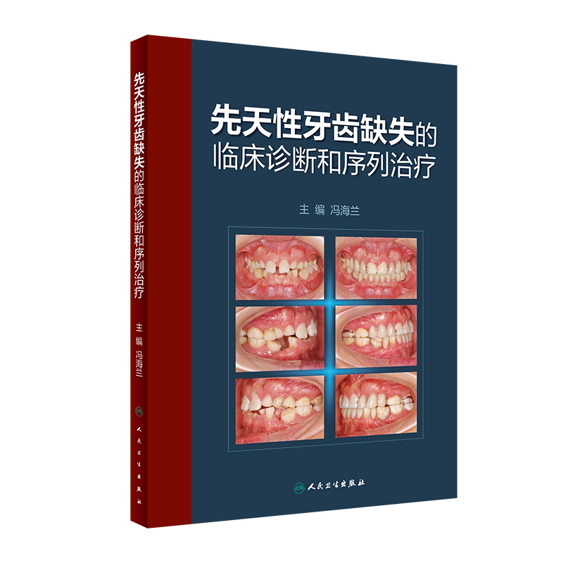 正版 先天性牙齿缺失的临床诊断和序列治疗 冯海兰 主编 口腔科学书籍 口腔功能恢复治疗临床处理 人民卫生出版社9787117311694