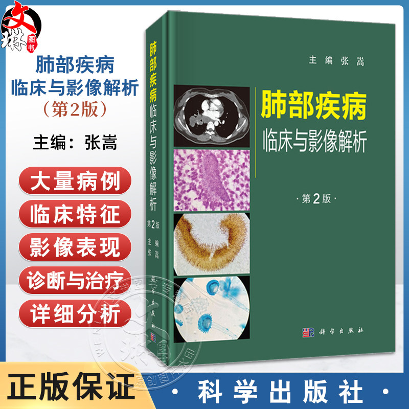 肺部疾病临床与影像解析 第2二版 张嵩 适合呼吸与危重症科 影像科医师 临床医学研究生 进修生及相关人员阅读参考 科学出版社
