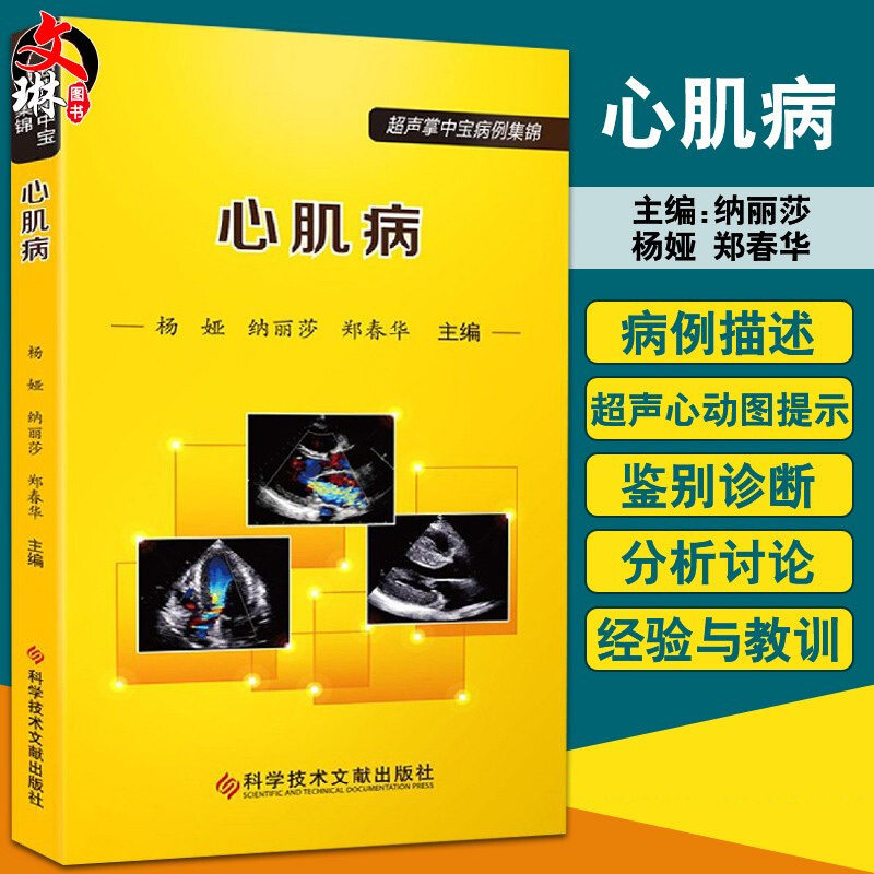 超声心动图的表现,鉴别诊断及分析讨论 限制型心肌病 杨娅 纳丽莎 郑